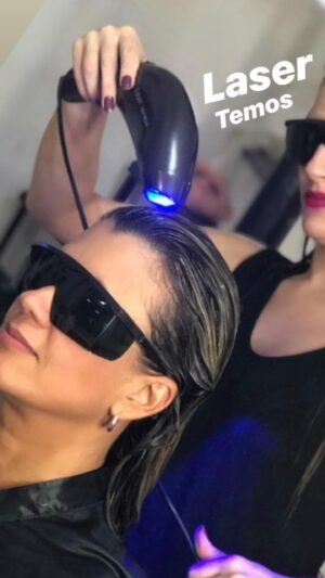 Lizze  Laser Capilar Photon Tratamento Químicas Profissional Azul - Imagem 2